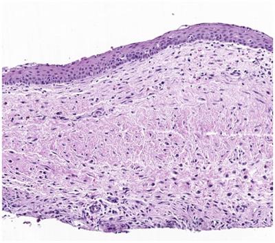 Clinical and histopathological study of 279 dentigerous cysts in 192 dogs (2012–2022)